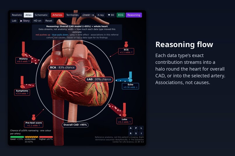 CardioVision – screenshot 2
