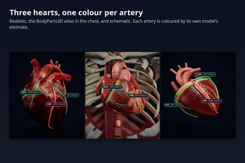 CardioVision – screenshot 4