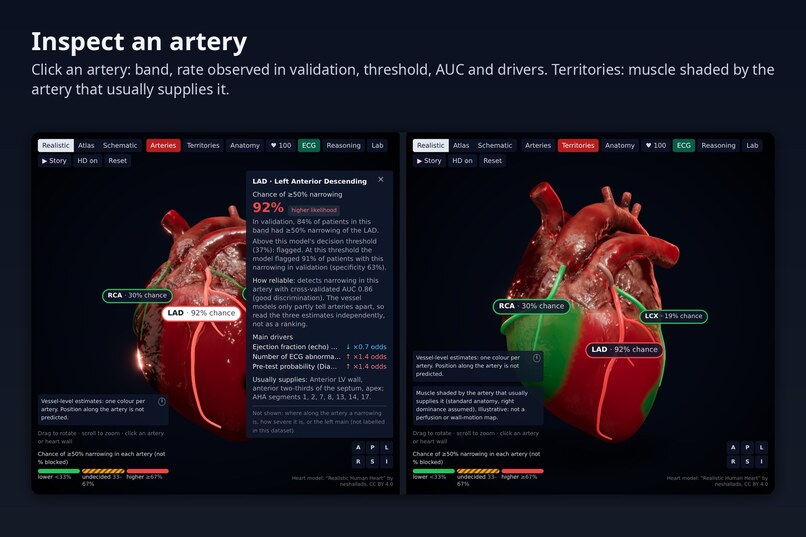 CardioVision – screenshot 7