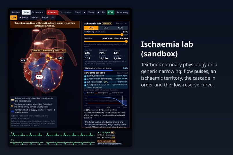 CardioVision – screenshot 8