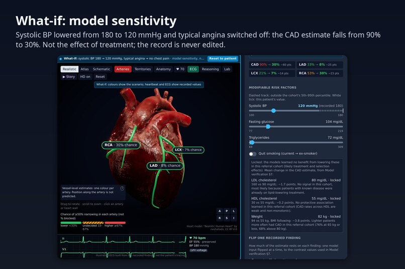 CardioVision – screenshot 9