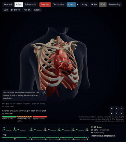 CardioVision – screenshot 10