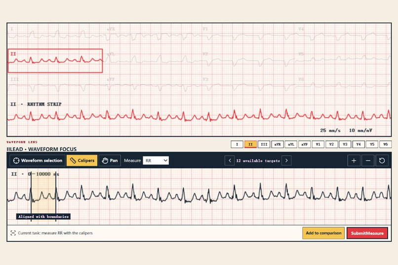 TraceMind: An Interactive AI ECG Tutor – screenshot 2