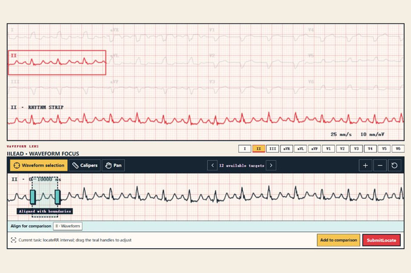 TraceMind: An Interactive AI ECG Tutor – screenshot 3