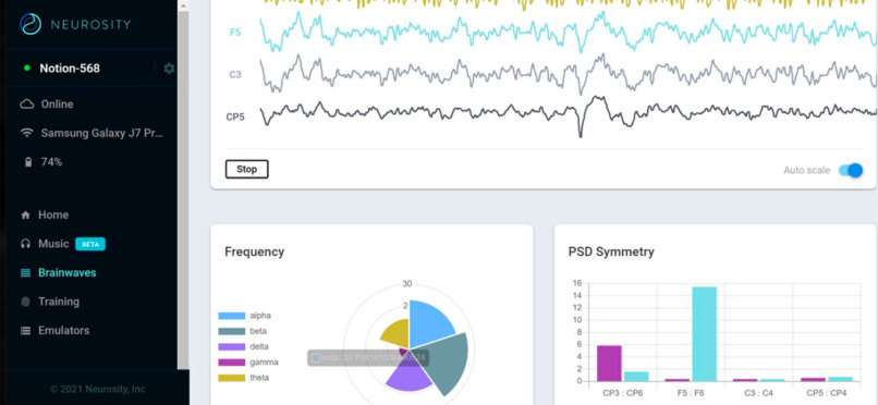 NeuroViu Research Agent – screenshot 3