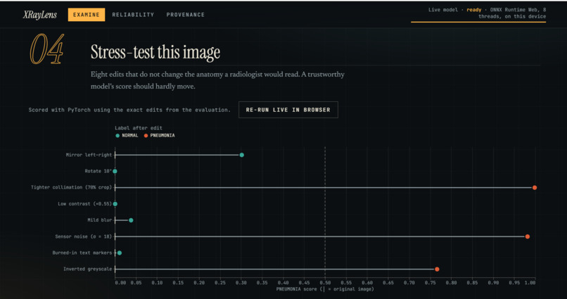 XrayLens AI – screenshot 1