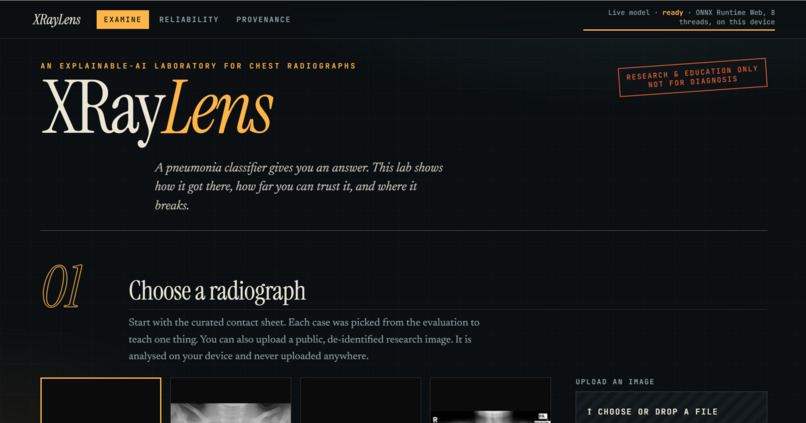 XrayLens AI – screenshot 2