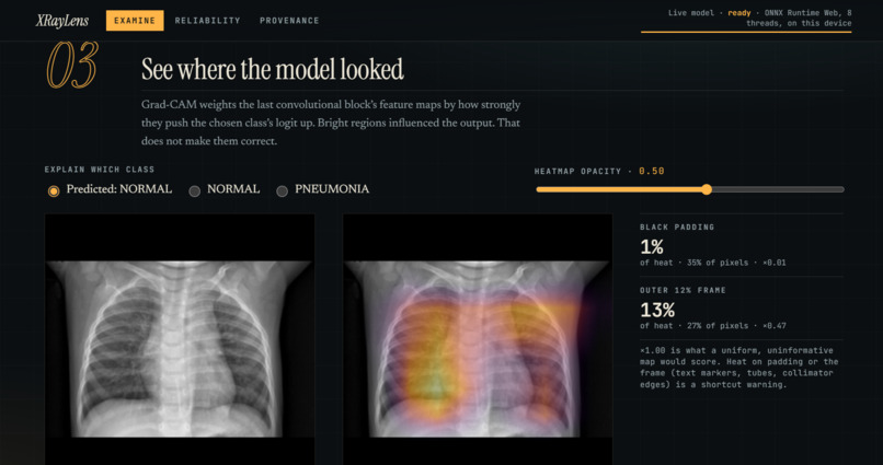 XrayLens AI – screenshot 3