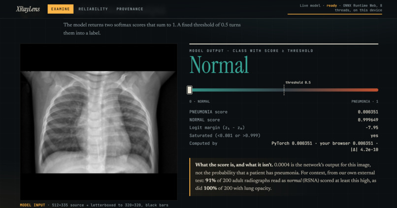 XrayLens AI – screenshot 4