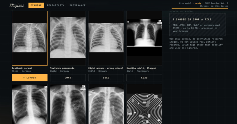 XrayLens AI – screenshot 5