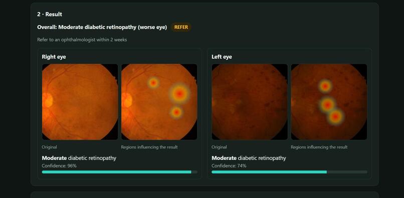 RetinaX – screenshot 5