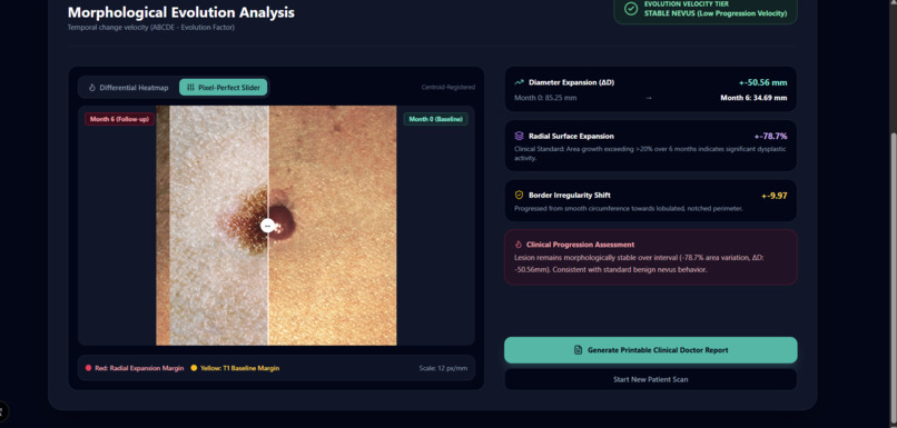DermaTrack: Longitudinal ABCDE Melanoma Progression Tracker – screenshot 5