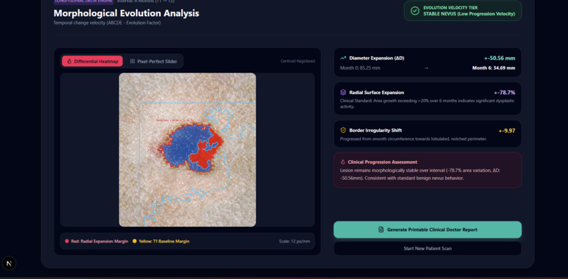 DermaTrack: Longitudinal ABCDE Melanoma Progression Tracker – screenshot 6