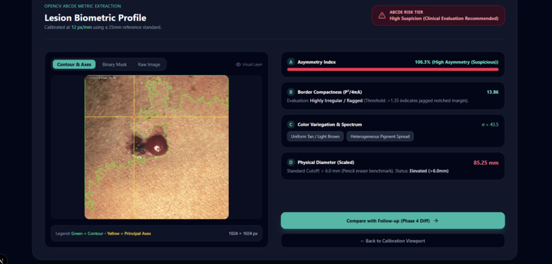 DermaTrack: Longitudinal ABCDE Melanoma Progression Tracker – screenshot 7