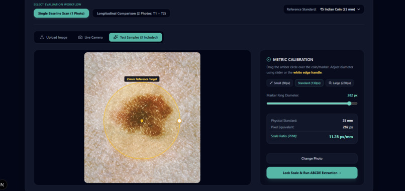 DermaTrack: Longitudinal ABCDE Melanoma Progression Tracker – screenshot 9