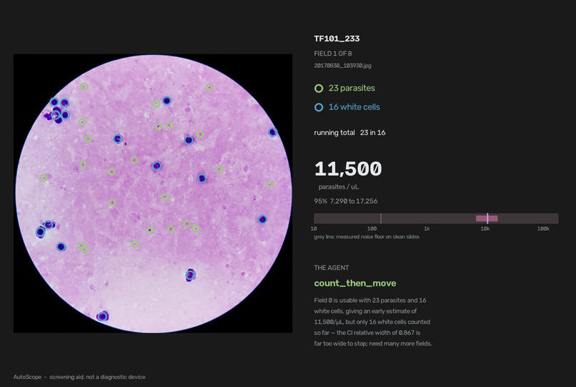 AutoScope: Adaptive Malaria Microscopy – screenshot 2