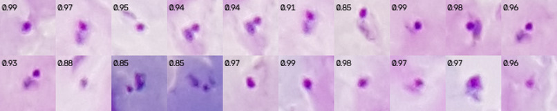 AutoScope: Adaptive Malaria Microscopy – screenshot 3