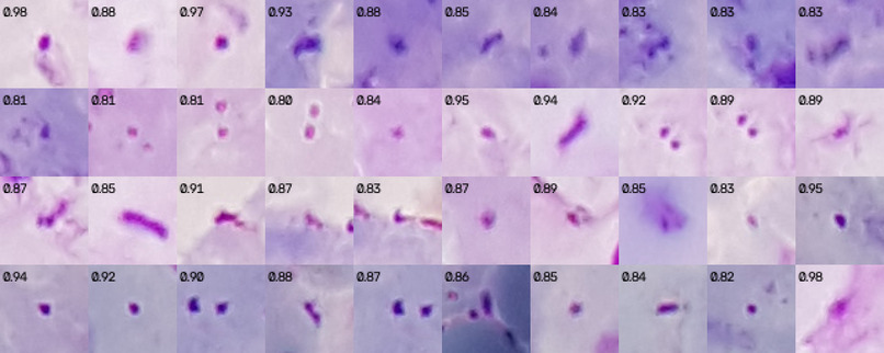 AutoScope: Adaptive Malaria Microscopy – screenshot 4