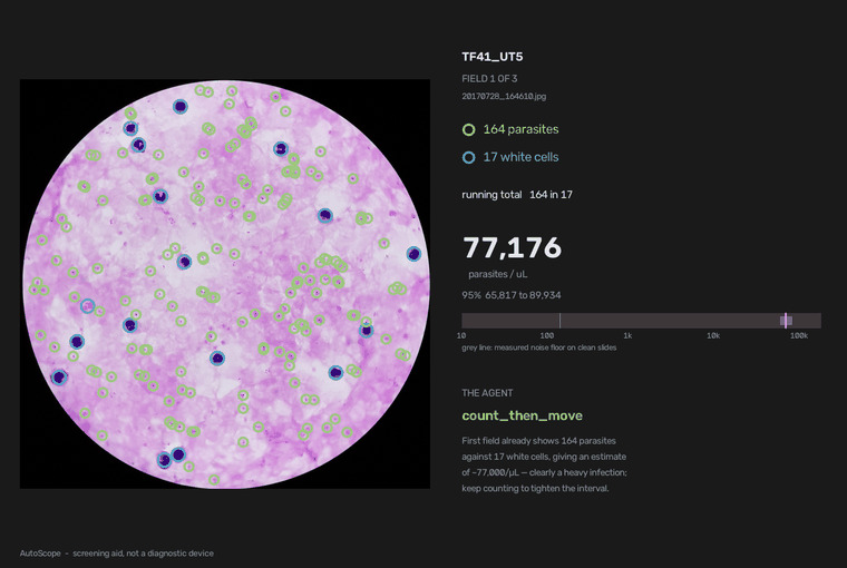 AutoScope: Adaptive Malaria Microscopy – screenshot 6