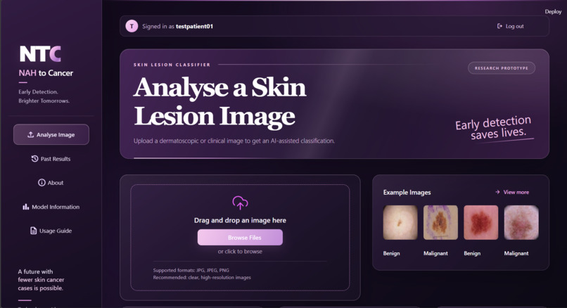 NTC - Melanoma Detection – screenshot 2