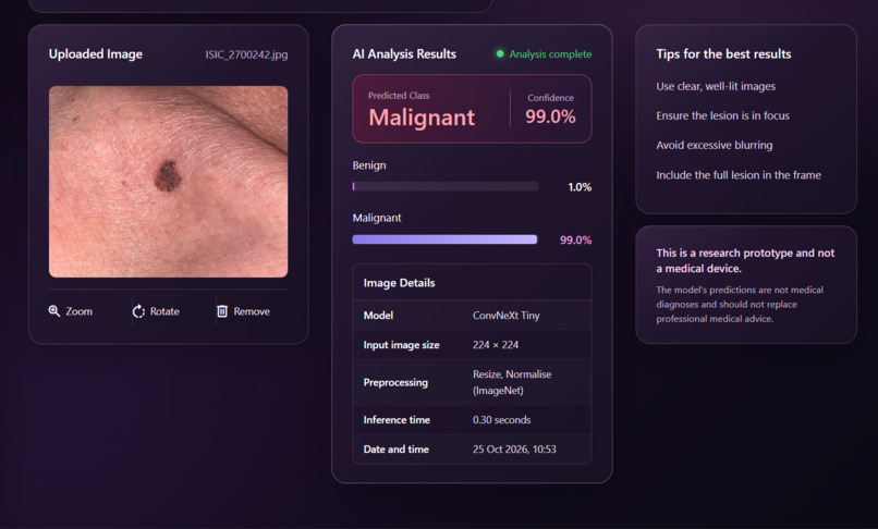 NTC - Melanoma Detection – screenshot 3