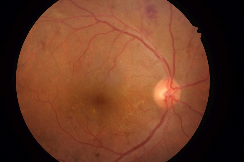 RetinaTransform – screenshot 4