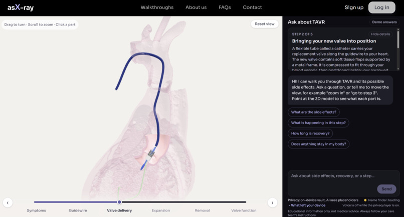 Ask-Ray – screenshot 1