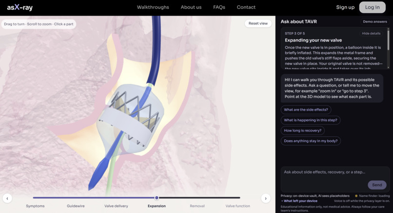 Ask-Ray – screenshot 3
