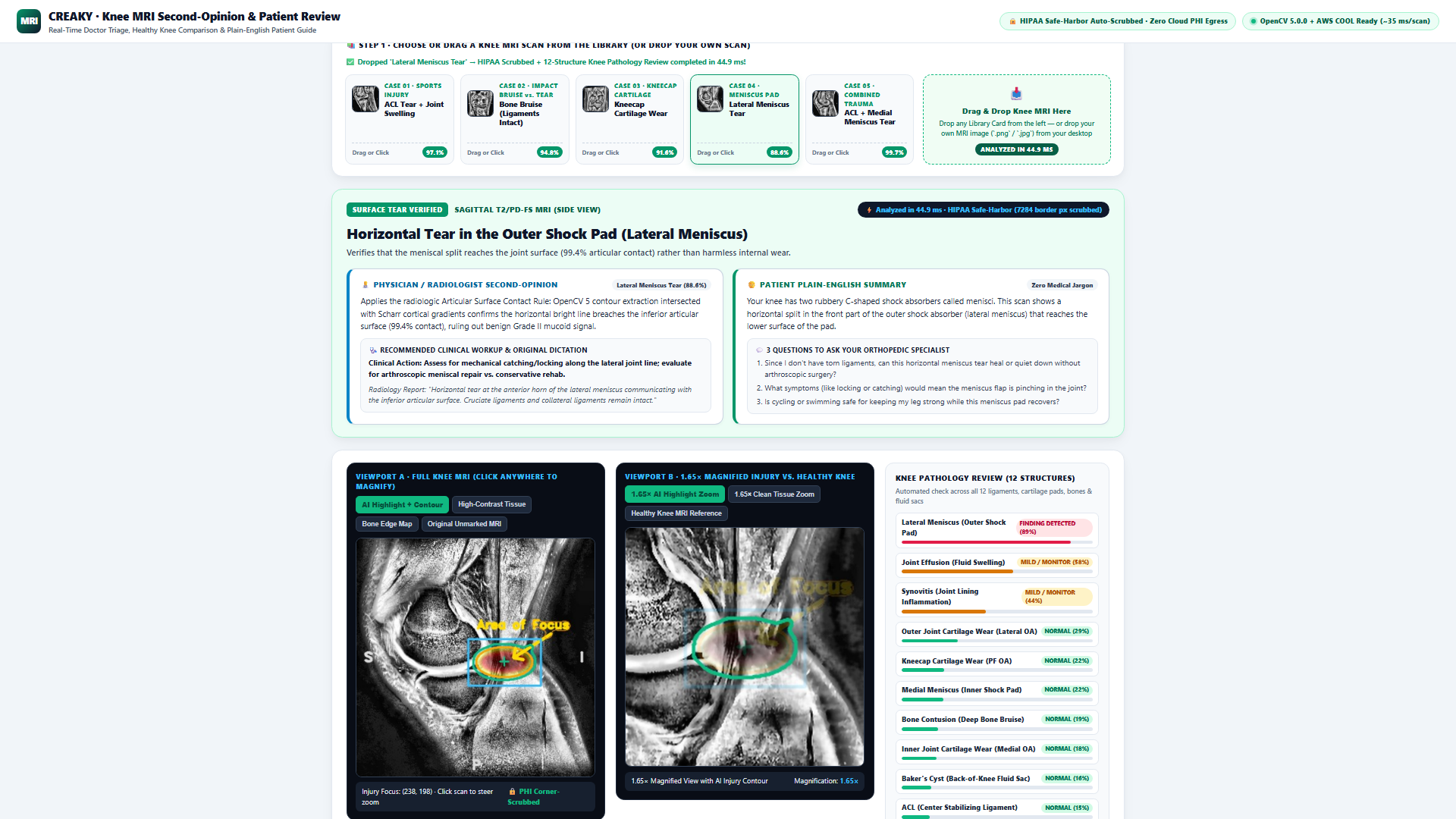 Creaky-CV5: Autonomous 3-Plane Knee MRI Triage | Devpost
