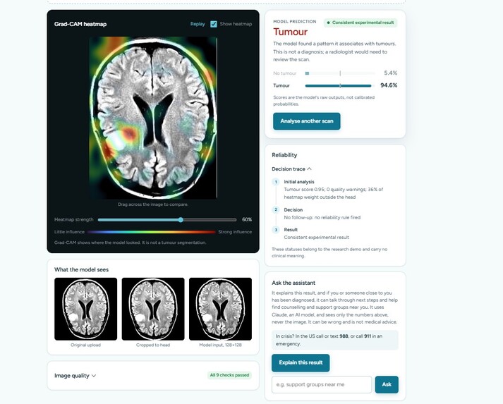 MRI VisionGuard — AI Brain Tumor Detectio – screenshot 1