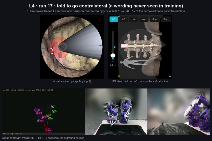 Spine IL: a surgeon's hands teach robot arms where to drill – screenshot 4