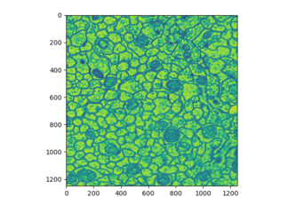 Pixel Level Segmentation of MRI Imaging
