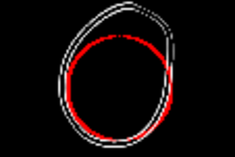 Circlejerk