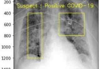 COVID-19-Detection-Device