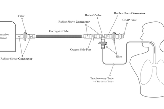 NIV to IMV Conversion
