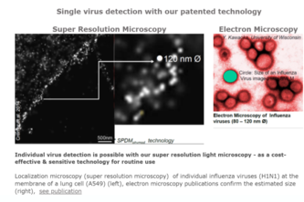 Corona Virus Detection with Super Resolution Microscopy