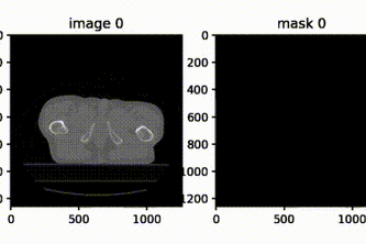 CT Image Segmentation