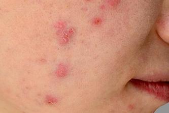 AI-Medical-Diagnosis