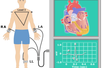 Delving deep into ECG signal quality assessment 