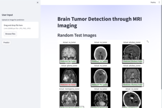 Brain Tumor Classification