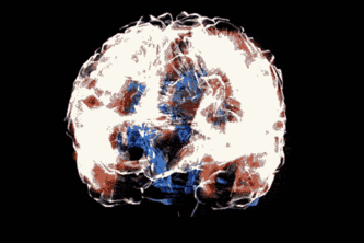 Alita - The Smartest Mental Health Companion