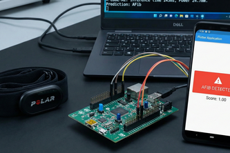 Ai-Based-Afib-Detection