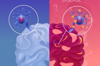 Detecting Alzheimer's with CNNs