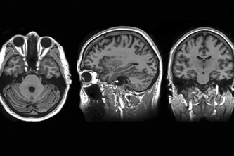 Neuro-MRI Classifier