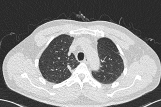 LungOC - Lung Cancer Risk Prediction System Analysis Tool