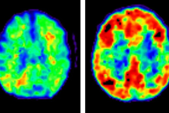 MLers – (Lasmar, Maésha, Richard, Ahmed)