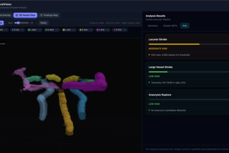 VascuSense - Cerebrovascular arterial blood vessel analysis