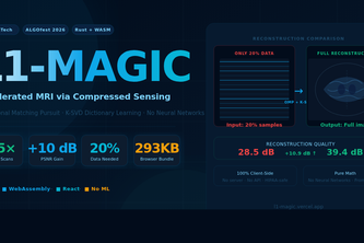 L1-MAGIC