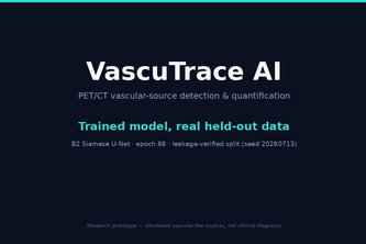 VASCTRACE AI