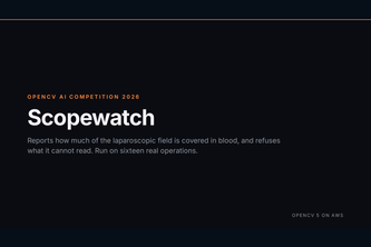 Scopewatch